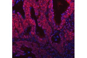 IF analysis of SNRNP200 using anti-SNRNP200 antibody (ABIN7602032). (SNRNP200 antibody  (AA 557-2129))