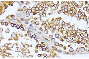Immunohistochemistry (Paraffin-embedded Sections) (IHC (p)) image for anti-Carbamoyl-Phosphate Synthetase 2, Aspartate Transcarbamylase, and Dihydroorotase (CAD) antibody (ABIN7264367)