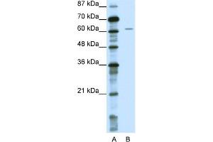 WB Suggested Anti-NOTCH4 Antibody Titration:  0. (NOTCH4 antibody  (Middle Region))