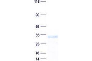 Validation with Western Blot (DDHD2 Protein (His tag))