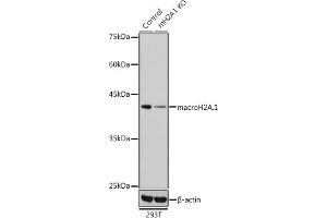 Western blot analysis of extracts from normal (control) and macroH2A. (H2AFY antibody  (AA 123-372))