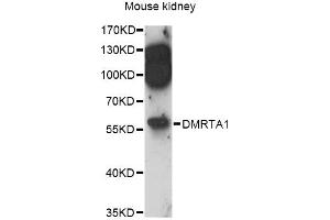 Western blot analysis of extracts of mouse kidney, using DMRTA1 antibody (ABIN6292013) at 1:3000 dilution.