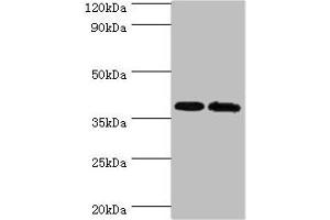 Western blot All lanes: PBK antibody at 6 μg/mL Lane 1: Hela whole cell lysate Lane 2: Mouse gonad tissue Secondary Goat polyclonal to rabbit IgG at 1/10000 dilution Predicted band size: 37, 38 kDa Observed band size: 37 kDa (PBK antibody  (AA 1-322))