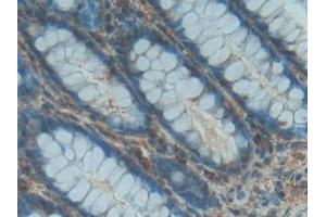 Detection of PDGF BB in Human Rectum Tissue using Polyclonal Antibody to Platelet Derived Growth Factor BB (PDGF BB) (PDGF-BB Homodimer (AA 82-190) antibody)