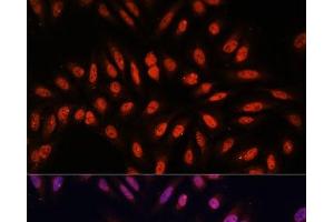 Immunofluorescence analysis of U-2 OS cells using KLHL8 Polyclonal Antibody at dilution of 1:100. (KLHL8 antibody)