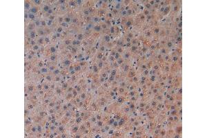 Immunohistochemistry (IHC) image for anti-Chemokine (C Motif) Ligand 1 (XCL1) (AA 27-107) antibody (ABIN1859694)