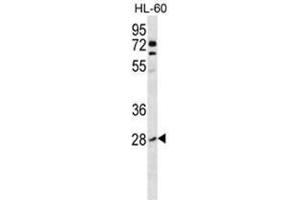 ARHB Antibody (Center) western blot analysis in HL-60 cell line lysates (35µg/lane). (RHOB antibody  (Middle Region))