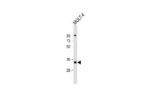 Anti-ZWINT Antibody (Center) at 1:1000 dilution + MOLT-4 whole cell lysate Lysates/proteins at 20 μg per lane.