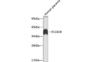 Western blot analysis of extracts of human placenta, using FCGR2B antibody  at 1:1000 dilution. (FCGR2B antibody  (AA 241-310))
