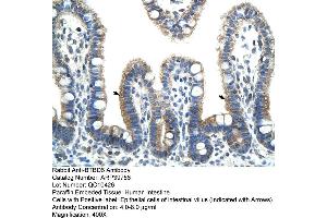 Human Intestine (BTBD6 antibody  (N-Term))