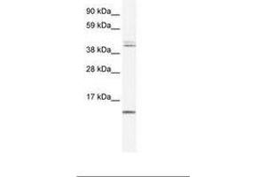 Image no. 2 for anti-Ts Translation Elongation Factor, Mitochondrial (TSFM) (AA 76-125) antibody (ABIN6735975) (TSFM antibody  (AA 76-125))