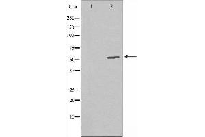 Western blot analysis of extracts from CoLo cells, using RBBP5 antibody. (RBBP5 antibody  (Internal Region))