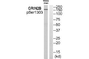 Western blot analysis of extracts from Mouse brain cells, using GRIN2B (Phospho-Ser1303) antibody. (GRIN2B antibody  (pSer1303))