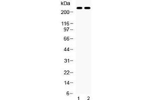 Western Blotting (WB) image for anti-ATP-Binding Cassette, Sub-Family A (ABC1), Member 4 (ABCA4) (AA 1890-1927) antibody (ABIN5647438)