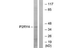 Western blot analysis of extracts from HeLa cells, using P2RY4 Antibody.