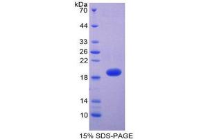SDS-PAGE (SDS) image for Thrombomodulin (THBD) protein (His tag) (ABIN1171442)