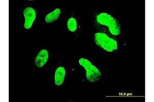Immunofluorescence of monoclonal antibody to TBX3 on HepG2 cell. (TBX3 antibody  (AA 311-410))