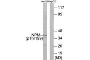 Western blot analysis of extracts from HepG2 cells, using NPM (Phospho-Thr199) Antibody. (NPM1 antibody  (pThr199))
