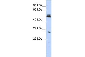 WB Suggested Anti-RNF212 Antibody Titration:  0. (RNF212 antibody  (Middle Region))