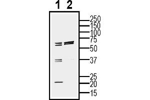 Western blot analysis of mouse  cell line lysate (lane 1) and BV2-derived purified exosomes (lane 2)50 μg of cells and purified exosomes lysates were analyzed using Anti-CD81 (extracellular) Antibody (ABIN7581847), (1:200). (CD81 antibody  (Extracellular))