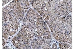 IHC analysis of CSNK2K2 using anti-CSNK2K2 antibody (ABIN7602871). (CSNK2A2 antibody  (C-Term))