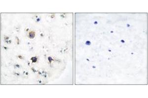 Immunohistochemistry analysis of paraffin-embedded human brain tissue, using EFNB3 Antibody. (Ephrin B3 antibody  (AA 221-270))