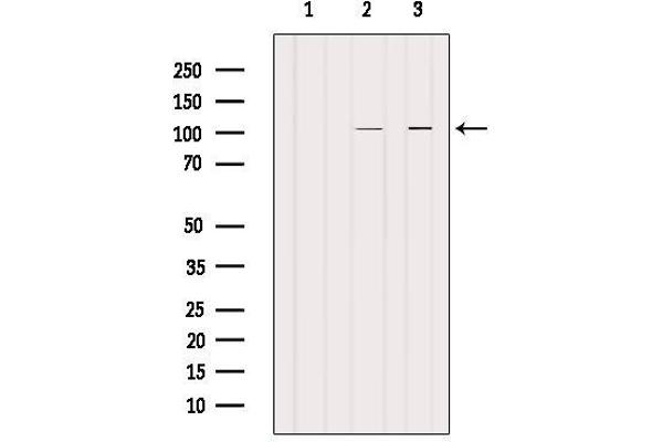 PDE6A antibody  (N-Term)