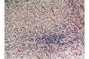 Immunohistochemistry (IHC) analysis of paraffin-embedded Human Liver, antibody was diluted at 1:100. (XCL1 antibody  (Internal Region))