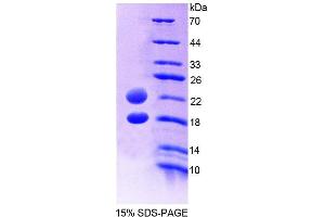 SDS-PAGE (SDS) image for Arginine Vasopressin Induced Protein 1 (AVPI1) (AA 27-147) protein (His tag) (ABIN6239506)