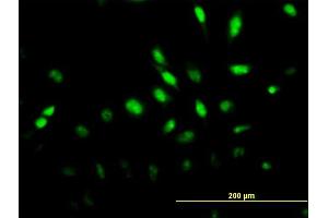 Immunofluorescence of monoclonal antibody to MAPK6 on HeLa cell. (MAPK6 antibody  (AA 612-721))