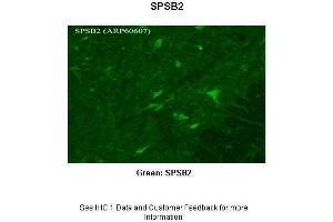 Sample Type : Rhesus macaque spinal cord Primary Antibody Dilution : 1:300 Secondary Antibody : Donkey anti Rabbit 488 Secondary Antibody Dilution : 1:500 Color/Signal Descriptions : Green: SPSB2 Gene Name : SPSB2 Submitted by : Timur Mavlyutov, Ph.