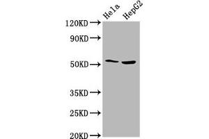 Western Blot Positive WB detected in: Hela whole cell lysate, HepG2 whole cell lysate All lanes: THNSL2 antibody at 4. (THNSL2 antibody  (AA 295-441))
