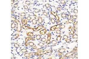 Immunohistochemistry analysis of paraffin-embedded rat kidney using,NHE-3 (ABIN7075685) at dilution of 1: 1200 (SLC9A3 antibody)