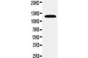 Anti-SLC12A1 antibody, Western blotting WB: Rat Kidney Tissue Lysate (SLC12A1 antibody  (N-Term))