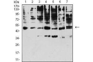 Western blot analysis using KIR3DL1 mouse mAb against A431 (1), Raji (2), SPC-A-1 (3), K562 (4), HEK293 (5), U937 (6), and C6 (7) cell lysate. (KIR3DL1 antibody  (AA 22-340))