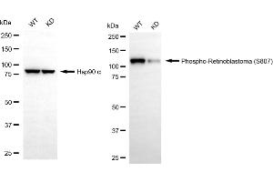 Western blotting analysis using phospho-retinoblastoma (S807) antibody (ABIN7800188). (Recombinant Retinoblastoma Protein (Rb) antibody  (pSer807))