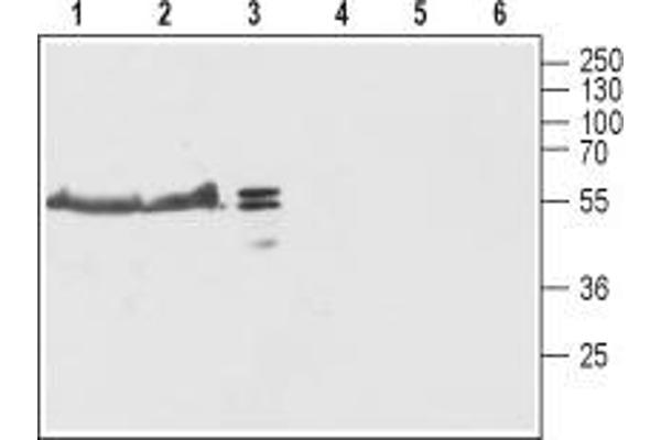 TMEM38B antibody  (Cytoplasmic Loop, Intracellular)