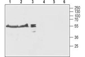 Western blot analysis of rat brain (lanes 1 and 4), mouse brain (lanes 2 and 5) and SH-SY5Y (lanes 3 and 6) lysates: - 1-3. (TMEM38B antibody  (Cytoplasmic Loop, Intracellular))
