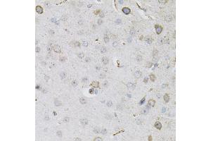 Immunohistochemistry of paraffin-embedded mouse brain using CEACAM5 antibody.