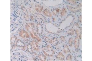 Detection of VNN1 in Human Kidney Tissue using Polyclonal Antibody to Vanin 1 (VNN1) (VNN1 antibody  (AA 36-223))