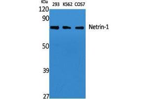 Western Blot (WB) analysis of specific cells using Netrin-1 Polyclonal Antibody.