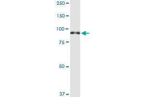 XPR1 monoclonal antibody (M06), clone 2G8. (xpr1 antibody  (AA 598-695))
