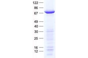 Validation with Western Blot (PFKFB1 Protein (His tag))