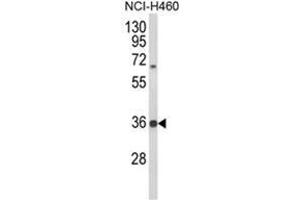 Western blot analysis of TAZ Antibody (N-term) in NCI-H460 cell line lysates (35ug/lane). (TAZ antibody  (N-Term))