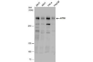 WB Image ATRX antibody detects ATRX protein by western blot analysis. (ATRX antibody  (C-Term))
