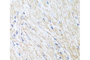 Immunohistochemistry of paraffin-embedded Mouse heart using L2HGDH Polyclonal Antibody at dilution of 1:100 (40x lens). (L2HGDH antibody)