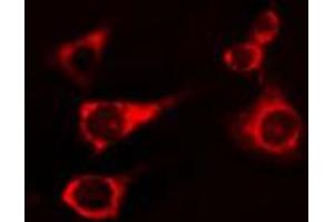 ABIN6274246 staining 293 cells by IF/ICC. (Activin A Receptor Type IB/ALK-4 antibody  (Internal Region))
