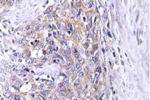 Image no. 2 for anti-Ceroid-Lipofuscinosis, Neuronal 6, Late Infantile, Variant (CLN6) antibody (ABIN317825) (CLN6 antibody)