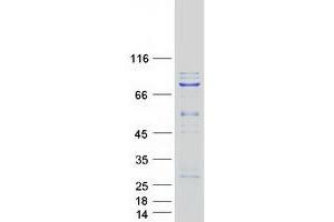 Validation with Western Blot (KLHL22 Protein (Myc-DYKDDDDK Tag))