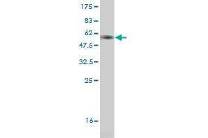 Western Blot detection against Immunogen (36. (CRYGD antibody  (AA 75-174))